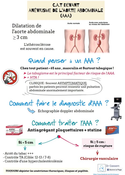 Anévrisme de l'aorte abdominal